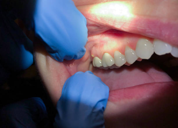 Best Urgent Dental Care  in Franklinville, NC